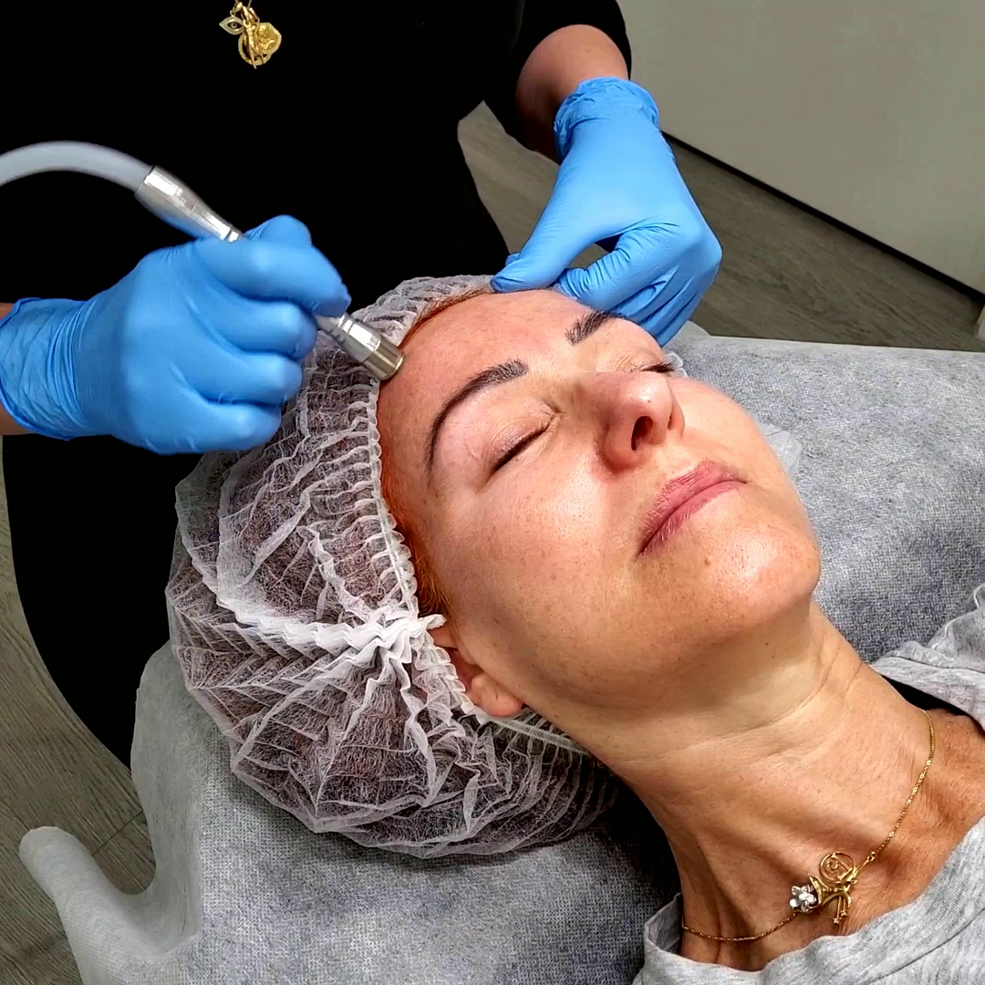 Client receiving a professional microdermabrasion treatment at Beautique Artistry