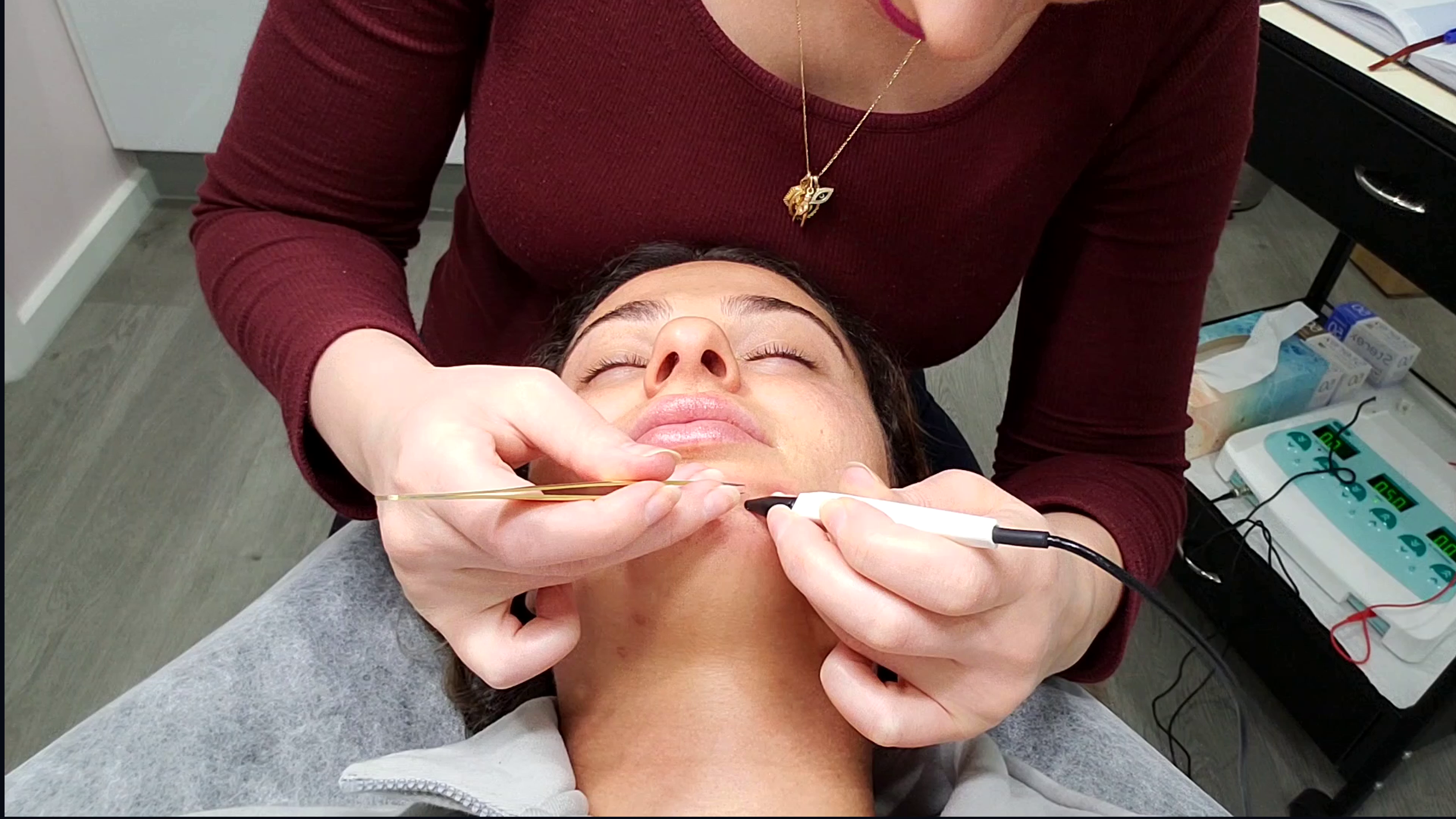 Precise facial electrolysis treatment in the Beautique Artistry treatment room